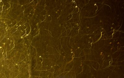 Fixed term contracts masterclass